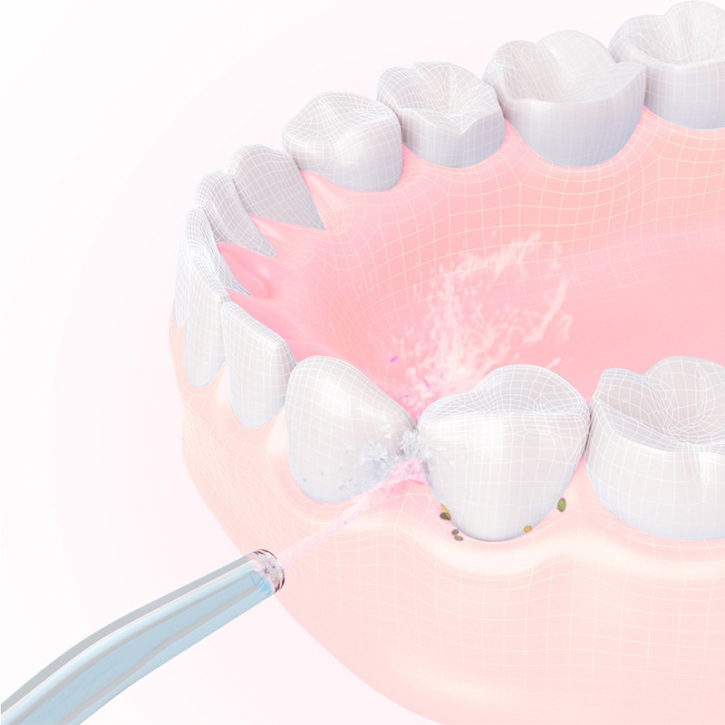 Replacement Water Flosser Nozz - đánh giá và giá Oral Irrigator Flosser