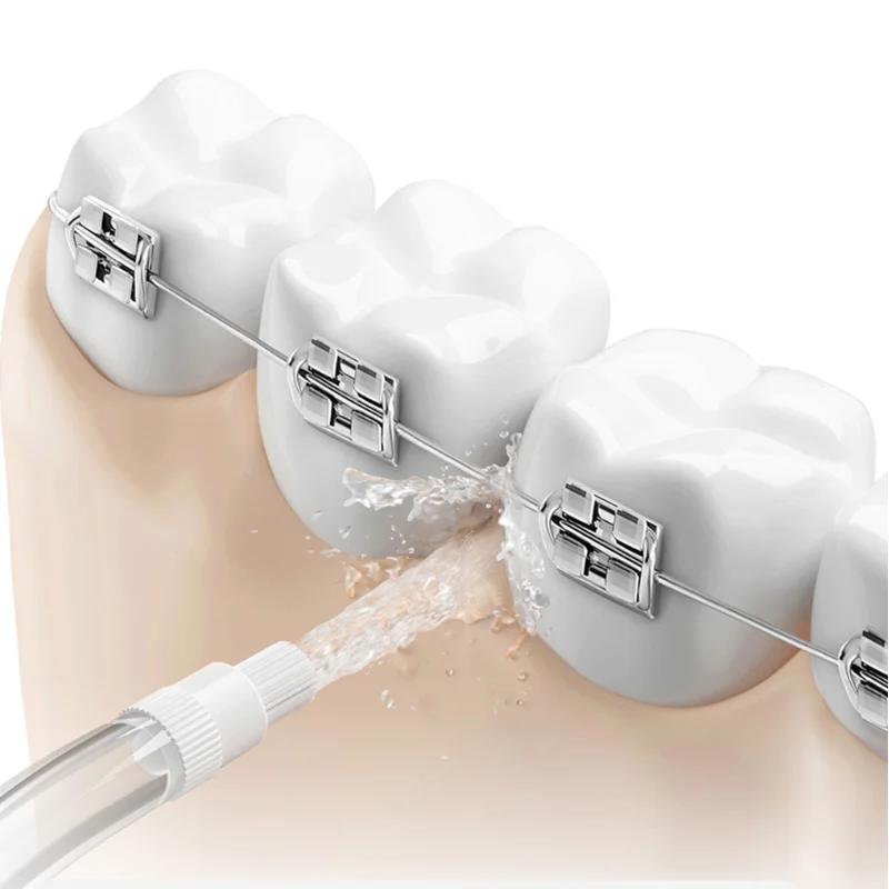 Original Nozzles for all Xiaom - đánh giá và giá Oral Irrigator Flosser